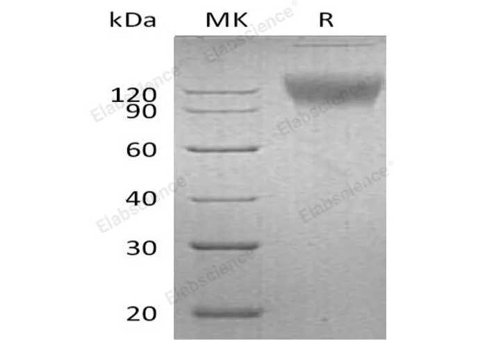 Recombinant Mouse SIRPA/CD172a Protein (Fc Tag) - image 1