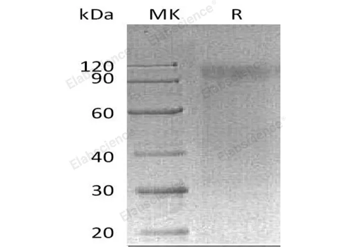 Recombinant Mouse SIRPA/CD172a Protein (MIgG2a Tag) - image 1