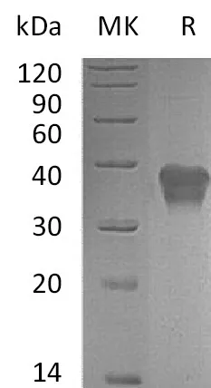 Recombinant Mouse TSLP Receptor/CRLF2 Protein (His Tag) - image 1
