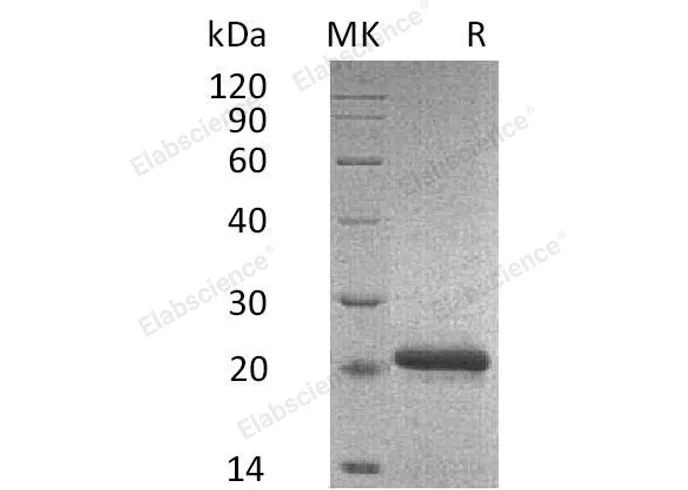 Recombinant Mouse TIMP2/TIMP-2 Protein (His Tag) - image 1