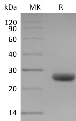 Recombinant Mouse TIMP1/TIMP Protein - image 1