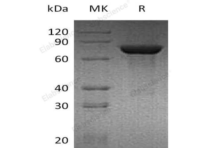 Recombinant Mouse TGM2/Transglutaminase 2 Protein (His Tag) - image 1