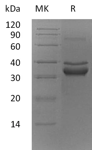 Recombinant Mouse FN14/TWEAKR Protein (Fc Tag) - image 1