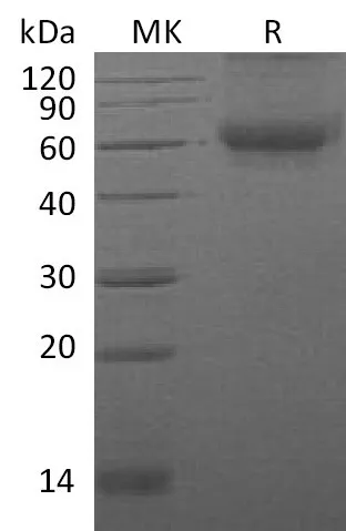 Recombinant Mouse DDR2 Kinase/CD167b Protein (His Tag) - image 1