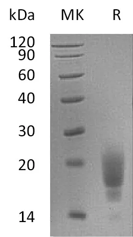Recombinant Mouse TIGIT Protein (His Tag) - image 1