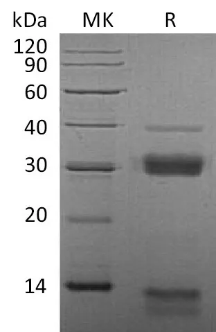 Recombinant Mouse Cathepsin S/CTSS Protein (His Tag) - image 1