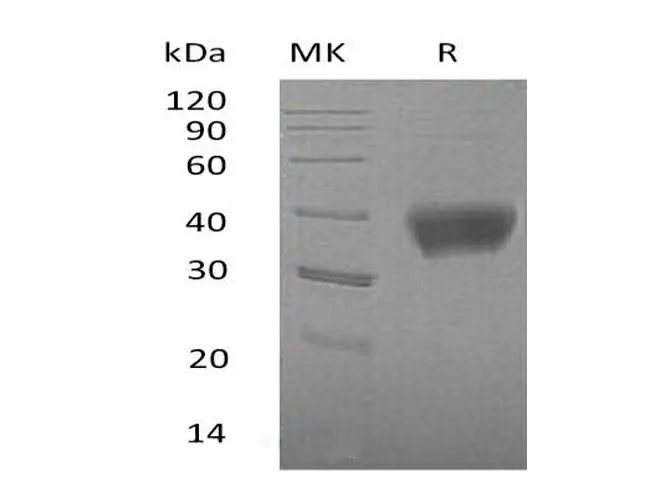 Recombinant Mouse SIGLEC3/CD33 Protein (His Tag) - image 1
