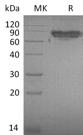 Recombinant Mouse ICAM-2/CD102 Protein (Fc Tag) - image 1