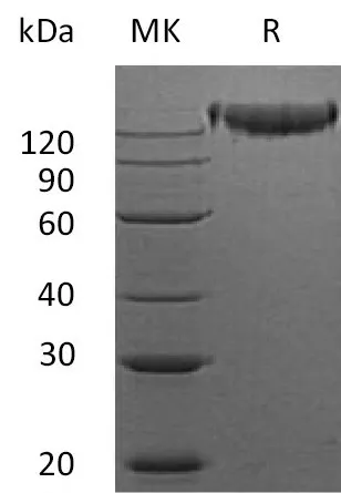Recombinant Mouse Semaphorin-4D/SEMA4D Protein (Fc Tag) - image 1