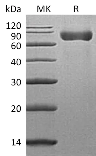 Recombinant Mouse SLAMF3/CD229 Protein (His Tag) - image 1