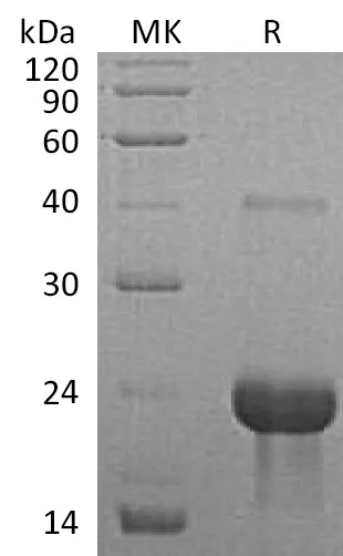 Recombinant Mouse TNFR1/TNFRSF1A Protein - image 1