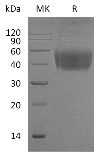 Recombinant Mouse CD80/B7-1 Protein (His Tag) - image 1