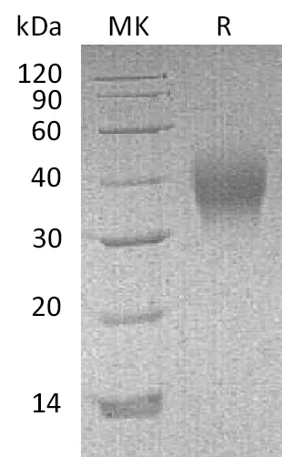 Recombinant Mouse CD16/FCGR3 Protein (His Tag) - image 1