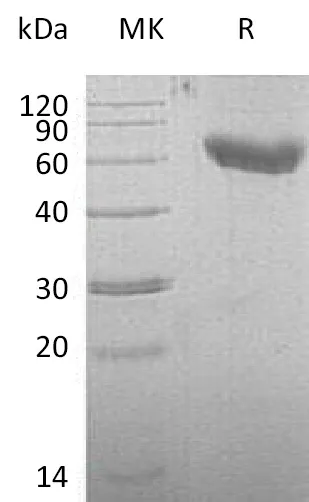Recombinant Mouse CD28/TP44 Protein (Fc & His Tag) - image 1