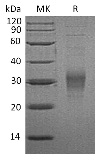 Recombinant Mouse CD16-2/FCGR4 Protein (His Tag) - image 1