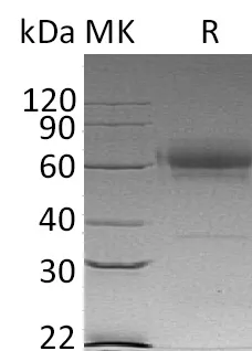 Recombinant Mouse CD27/TNFRSF7 Protein (Fc & His Tag) - image 1