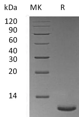 Recombinant Mouse Trefoil Factor 3/TFF3 Protein (His Tag) - image 1
