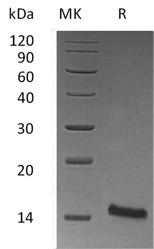 Recombinant Mouse Trefoil Factor 1/TFF1 Protein (His Tag) - image 1