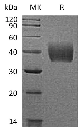 Recombinant Mouse Tissue Factor/TF Protein (His Tag) - image 1