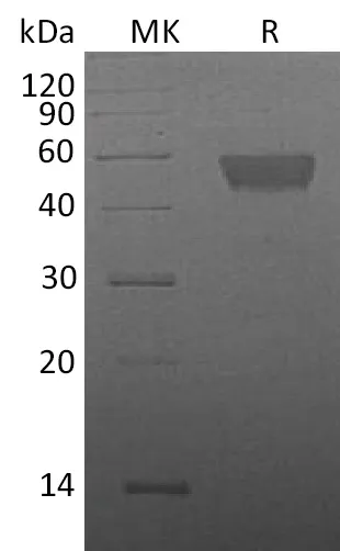 Recombinant Mouse TIGIT Protein (Fc Tag) - image 1