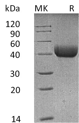 Recombinant Mouse SFTPD/SP-D Protein (His Tag) - image 1