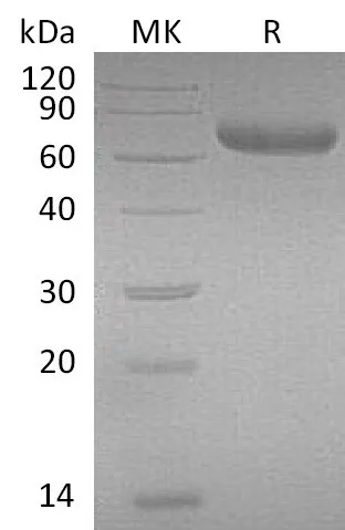 Recombinant Mouse PRLR/Prolactin Receptor Protein (Fc Tag) - image 1