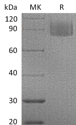 Recombinant Mouse MAG/Siglec-4a Protein (His Tag) - image 1