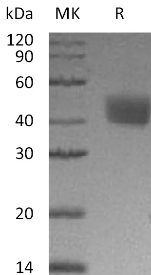 Recombinant Mouse Mesothelin/MSLN Protein (His Tag) - image 1