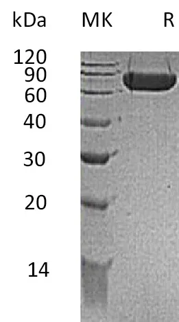 Recombinant Mouse KIRREL1/NEPH1 Protein (His Tag) - image 1