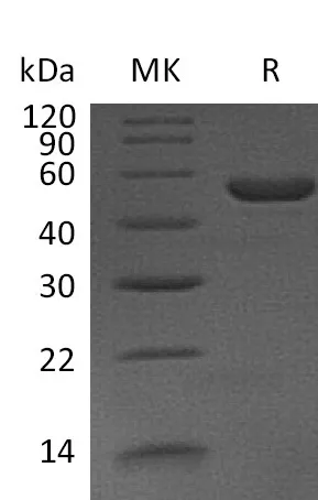 Recombinant Mouse Interleukin-11/IL-11 Protein (Fc Tag) - image 1