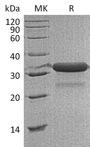 Recombinant Mouse IGFBP-7/IGFBP7 Protein (His Tag) - image 1