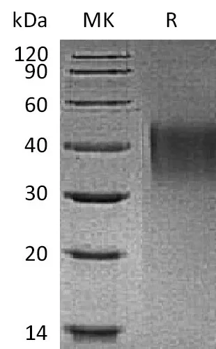 Recombinant Mouse TIM1/HAVCR1 Protein (His Tag) - image 1
