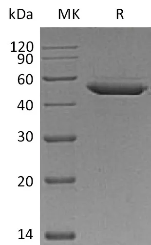 Recombinant Mouse SerpinE2/SERPINE2 Protein (His Tag) - image 1