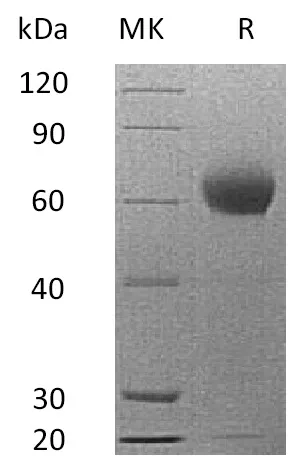 Recombinant Mouse Complement Factor H/CFH Protein (His Tag) - image 1