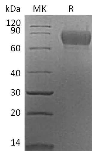 Recombinant Mouse SynCam/CADM1 Protein (aa 48-388, His Tag) - image 1