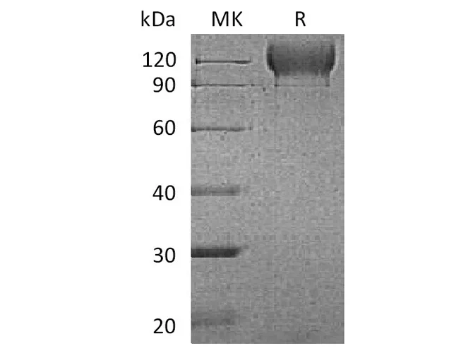 Recombinant Mouse P-selectin/CD62P Protein (AVI & His Tag) - image 1