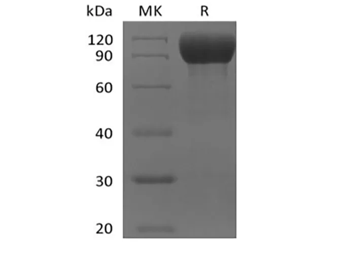Recombinant Mouse IL-1 Receptor-Like 2/IL-1RL2/IL-1Rrp2/IL-36R (C-Fc) - image 1
