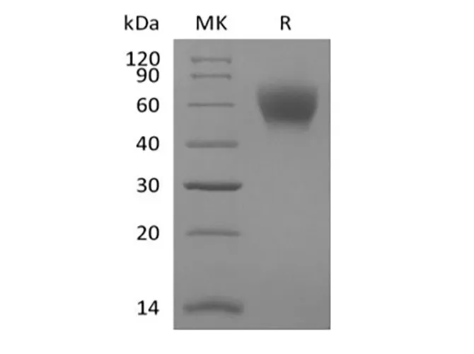 Recombinant Mouse TPBG/5T4 (C-6His) - image 1
