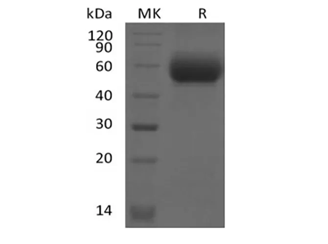 Recombinant Mouse IL-1 Receptor-Like 2/IL-1RL2/IL-1Rrp2/IL-36R (C-6His) - image 1