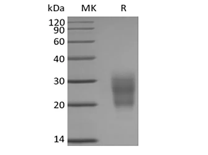 Recombinant Mouse NKG2-D type II Integral Membrane Protein/NKG2D/CD314 (N-6His) - image 1