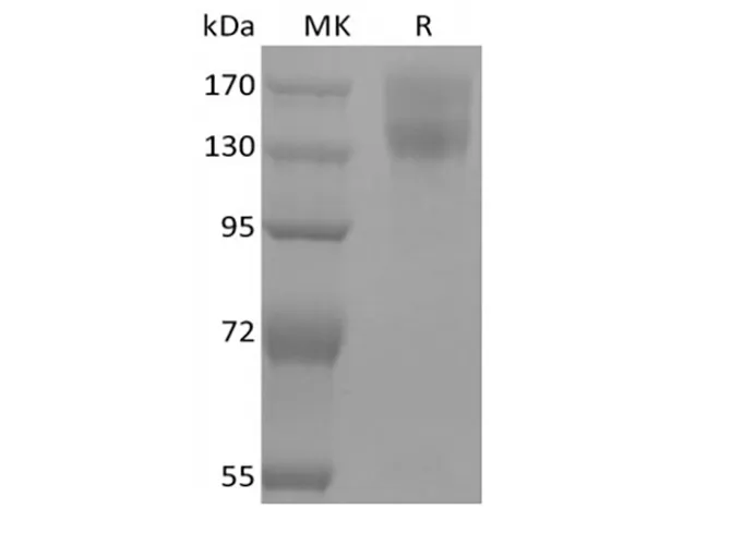 Recombinant Mouse Leptin Receptor/LEPR/CD295 (C-mFc) - image 1