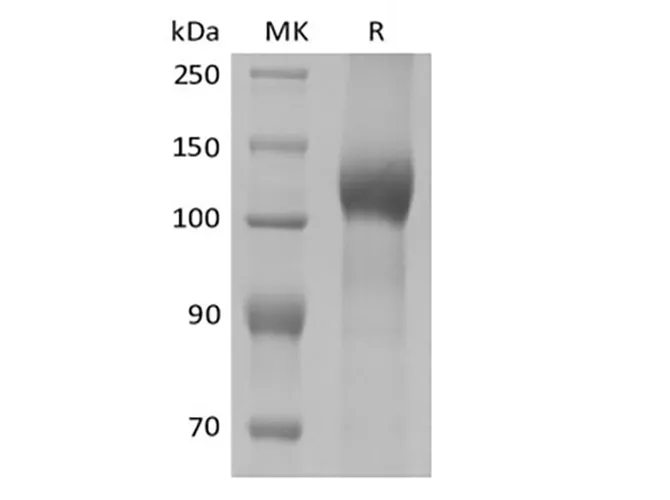 Recombinant Mouse Leptin Receptor/LEPR/CD295 (C-10His) - image 1