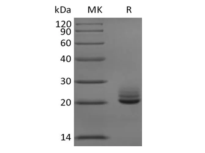 Recombinant Mouse Fibroblast Growth Factor 21/FGF-21 (C-6His) - image 1