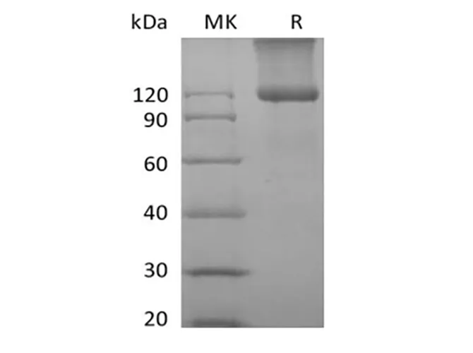 Recombinant Mouse TGFBR3 (C-6His) - image 1