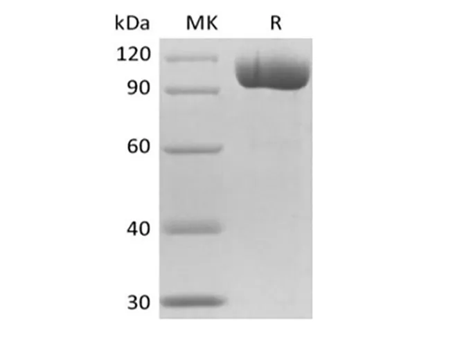 Recombinant Mouse FGCP/GCPII/mGCP/NAALADase I/PSMA(N-6His) - image 1