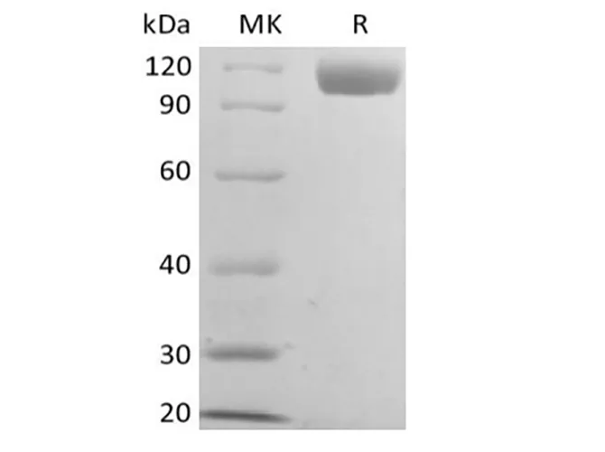 Recombinant Mouse B-cell Receptor CD22/Siglec-2/CD22 (C-6His) - image 1