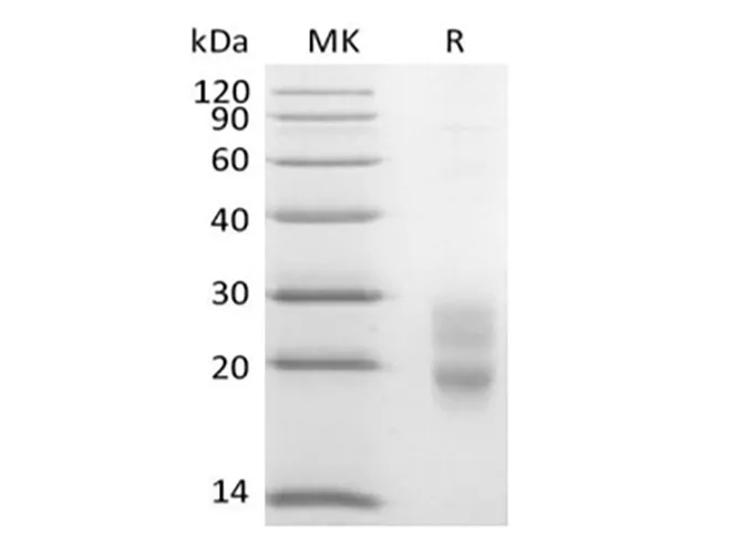 Recombinant Mouse CD7/Leu-9 (C-6His) - image 1