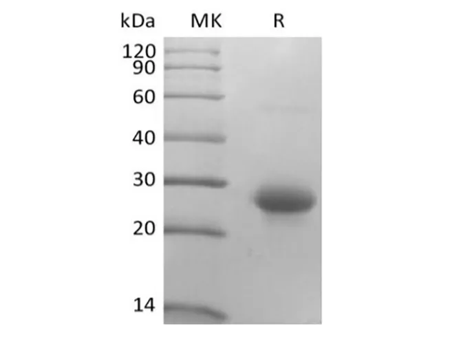 Recombinant Mouse CD27 Ligand/TNFSF7/CD70 (N-10His) - image 1