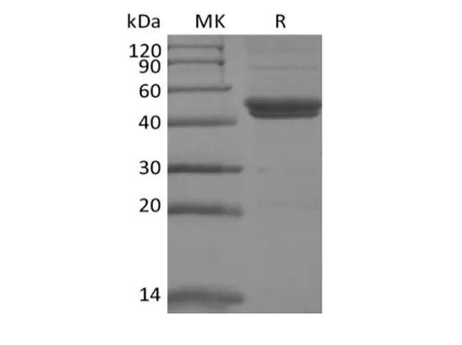 Recombinant Mouse IL-11RA (C-6His) - image 1