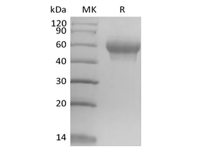 Recombinant Mouse IL-6 Receptor Subunit alpha/IL-6RA/CD126 (C-6His) - image 1
